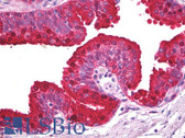Anti-ABCA5 Antibody IHC-plus LS-B6852
