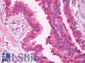 Anti-HnRNP-E1 / PCBP1 Antibody (Internal) IHC-plus LS-B6862