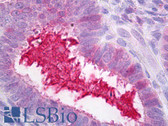 Anti-SERPING1 / C1 Inhibitor Antibody IHC-plus LS-B6864