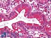 Anti-DISC1 Antibody (aa400-500) IHC-plus LS-B6875