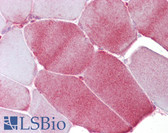 Anti-FABP3 / H-FABP Antibody (aa72-121) IHC-plus LS-B6877