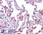 Anti-HPGDS Antibody (aa35-84) IHC-plus LS-B6886