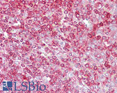 Anti-GCLC Antibody (aa323-372) IHC-plus LS-B6899