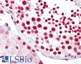 Anti-SIRT7 / Sirtuin 7 Antibody (C-Terminus) IHC-plus LS-B6912