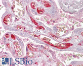 Anti-PPP2R3A / PR130 Antibody (aa179-228) IHC-plus LS-B6915