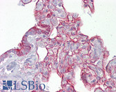 Anti-PTPN11 / SHP-2 / NS1 Antibody (aa143-192) IHC-plus LS-B6916
