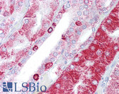 Anti-ACAT1 Antibody (C-Terminus) IHC-plus LS-B6919