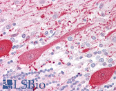 Anti-RET Antibody (C-Terminus) IHC-plus LS-B6923