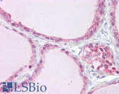 Anti-TRPM7 Antibody (N-Terminus) IHC-plus LS-B6929
