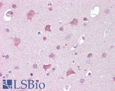 Anti-TRPM7 Antibody (C-Terminus) IHC-plus LS-B6930