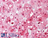 Anti-PEBP1 / RKIP Antibody (N-Terminus) IHC-plus LS-B6931