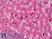 Anti-IGFBP5 Antibody IHC-plus LS-B6938