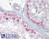 Anti-SCP1 / SYCP1 Antibody (aa72-121) IHC-plus LS-B6941