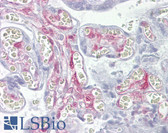 Anti-LGALS1 / Galectin 1 Antibody (aa72-121) IHC-plus LS-B6943