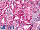 Anti-15-PGDH / HPGD Antibody IHC-plus LS-B6957
