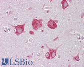 Anti-HEXA Antibody (aa431-480) IHC-plus LS-B6959