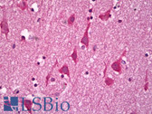 Anti-GUCY1B3 Antibody IHC-plus LS-B6961