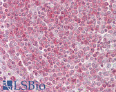 Anti-RIPK3 / RIP3 Antibody (aa251-300) IHC-plus LS-B6965