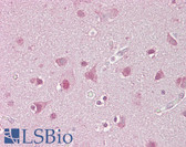 Anti-SREBF1 / SREBP-1 Antibody (aa461-510) IHC-plus LS-B6968