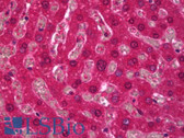 Anti-SPHK / SPHK1 Antibody IHC-plus LS-B6973