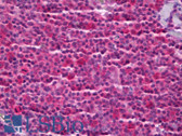 Anti-PTGES3 Antibody IHC-plus LS-B6976