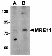Anti-MRE11A / MRE11 Antibody (N-Terminus) IHC-plus LS-B6978