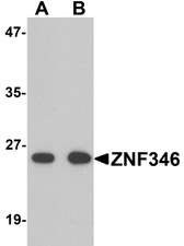 Anti-ZNF346 Antibody (N-Terminus) IHC-plus LS-B6981