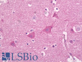 Anti-Synaptotagmin Antibody (aa276-325) IHC-plus LS-B6983
