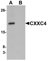 Anti-CXXC4 Antibody (N-Terminus) IHC-plus LS-B6986