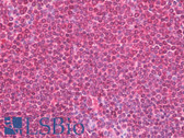 Anti-PLCG1 Antibody (aa751-800) IHC-plus LS-B6987