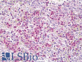 Anti-CSF2RB / CD131 Antibody (aa559-608) IHC-plus LS-B6993