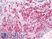 Anti-CALD1 / Caldesmon Antibody (aa744-793) IHC-plus LS-B6995