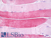 Anti-HSPB6 / HSP20 Antibody (aa5-54) IHC-plus LS-B6996