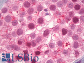 Anti-CCNE1 / Cyclin E1 Antibody (aa43-92) IHC-plus LS-B6998