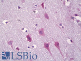 Anti-KCNIP3 / Dream / Calsenilin Antibody (aa29-78) IHC-plus LS-B7002