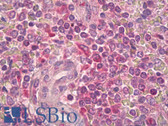 Anti-IL2RB / CD122 Antibody (aa331-380) IHC-plus LS-B7003