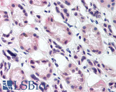 Anti-RREB1 Antibody IHC-plus LS-B111