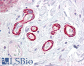 Anti-SLC39A14 / ZIP14 Antibody (Internal) IHC-plus LS-B7008