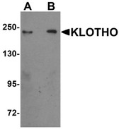 Anti-KL / Klotho Antibody (Internal) IHC-plus LS-B7010