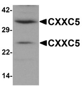 Anti-CXXC5 Antibody (N-Terminus) IHC-plus LS-B7014