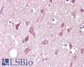 Anti-ZBTB6 Antibody (Internal) IHC-plus LS-B7025