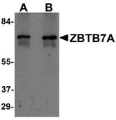 Anti-ZBTB7A / Pokemon Antibody (N-Terminus) IHC-plus LS-B7026