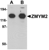 Anti-ZMYM2 / RAMP Antibody (C-Terminus) IHC-plus LS-B7027
