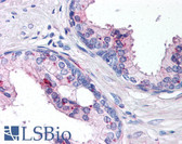 Anti-IL24 Antibody (aa100-150) IHC-plus LS-B113