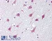 Anti-ZMYM3 Antibody (C-Terminus) IHC-plus LS-B7028