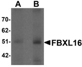 Anti-FBXL16 Antibody (C-Terminus) IHC-plus LS-B7030