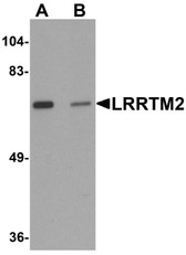 Anti-LRRTM2 Antibody (C-Terminus) IHC-plus LS-B7031