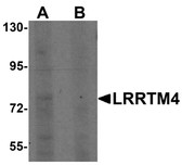 Anti-LRRTM4 Antibody (Internal) IHC-plus LS-B7032