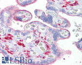 Anti-OGFOD1 Antibody (C-Terminus) IHC-plus LS-B7033