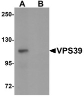 Anti-VPS39 Antibody (C-Terminus) IHC-plus LS-B7035